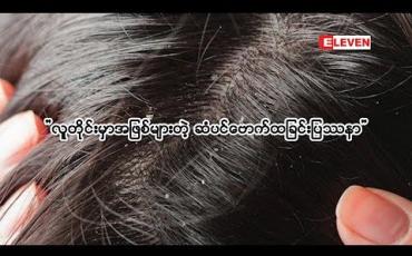 Embedded thumbnail for Beauty Box (ရုပ်သံအစီအစဉ်)