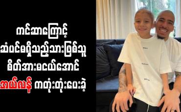 Embedded thumbnail for ကင်ဆာကြောင့် ဆံပင်မရှိသည့်သားဖြစ်သူ စိတ်အားမငယ်အောင် အယ်လန် ကတုံးတုံးပေးခဲ့