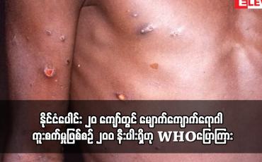 Embedded thumbnail for နိုင်ငံပေါင်း ၂၀ ကျော်တွင် မျောက်ကျောက်ရောဂါ ကူးစက်မှုဖြစ်စဉ် ၂၀ဝ နီးပါးရှိဟု WHOပြောကြား