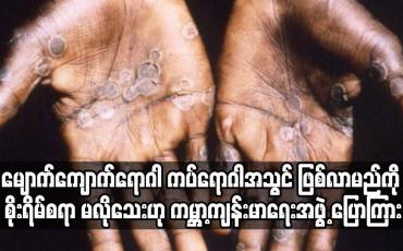 Embedded thumbnail for နိုင်ငံပေါင်း နှစ်ဒါဇင်နီးပါးတွင် ဖြစ်ပွားနေသော မျောက်ကျောက်ရောဂါ ကပ်ရောဂါအသွင် ဖြစ်လာမည်ကို စိုးရိမ်စရာ မလိုသေးဟု ကမ္ဘာ့ကျန်းမာရေးအဖွဲ့ ပြောကြား