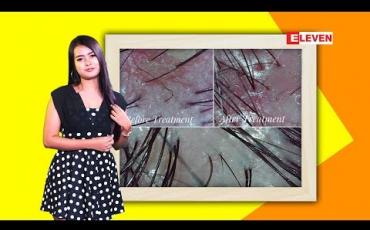 Embedded thumbnail for Beauty Box(ရုပ်သံအစီအစဉ်)