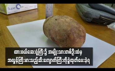 Embedded thumbnail for ထားဝယ်ပြည်သူ့ဆေးရုံကြီး၌ အသက် ၅၆ နှစ်အရွယ်အမျိုးသားတစ်ဦးထံမှ အလျား ၅ လက်မခွဲ၊ အနံ ၃ လက်မခွဲနှင့် အမြင့် ၃ လက်မခန့် အရွယ်ရှိ ဆီးကျောက်ကြီးကို ခွဲထုတ်ပေးခဲ့ရ