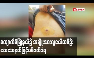 Embedded thumbnail for ကျောက်မဲမြို့နယ်၌အမျိုးသားလူငယ်တစ်ဦး လေသေနတ်ဖြင့်ပစ်ခတ်ခံရ