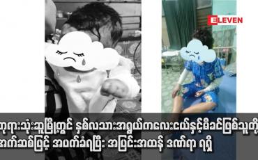 Embedded thumbnail for ဘုရားသုံးဆူမြို့တွင် နှစ်လသားအရွယ် ကလေးငယ်နှင့်မိခင်ဖြစ်သူတို့ အက်ဆစ်ဖြင့် အပက်ခံရပြီး အပြင်းအထန် ဒဏ်ရာရရှိ