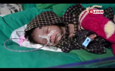 Embedded thumbnail for  အိန္ဒိယတွင်အရှင်လတ်လတ်မြေမြှုပ်ခံခဲ့ရသည့်မွေးကင်းစကလေးအံ့ဖွယ်အသက်ရှင်နေမှုကို ဆရာဝန်တွေအံ့သြ (ရုပ်သံ)