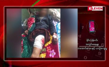Embedded thumbnail for မီးသွေးတင်ကားမောင်းနှင်လာသူတစ်ဦးကို ပျောက်ကြားဝတ်ဆင်ထားသူ လူတစ်စုက သေနတ်ဖြင့် အနီးကပ်ပစ်ခတ်ခဲ့ 