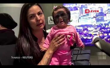 Embedded thumbnail for ရှားပါးအရေပြားရောဂါနှင့်ကလေးငယ် ခွဲစိတ်ကုသမှုခံယူရန်ရုရှားသို့ရောက်ရှိ