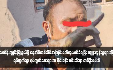 Embedded thumbnail for သင်္ဃန်းကျွန်းမြို့နယ်ရှိ နေအိမ်တစ်အိမ်အကြမ်းဖက်လုယက်ခံရပြီး ကျူးလွန်သူများကို ရပ်ကွက်သူ၊ ရပ်ကွက်သားများက ဝိုင်းဝန်း ဖမ်းဆီးရာ တစ်ဦးဖမ်းမိ 