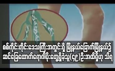 Embedded thumbnail for စစ်ကိုင်းတိုင်းဒေသကြီးအတွင်းရှိ မြို့နယ်ခြောက်မြို့နယ်၌ ဆင်ခြေထောက်ရောဂါပိုးတွေ့ရှိခဲ့သူ(၄၉)ဦးအထိရှိဟုသိရ (ရုပ်သံ)