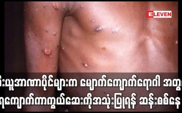 Embedded thumbnail for အီးယူဆေးဝါးအာဏာပိုင်များက မျောက်ကျောက်ရောဂါအတွက် ရေကျောက်ကာကွယ်ဆေးကို အသုံးပြုရန် ဆန်းစစ်သုံးသပ်နေ