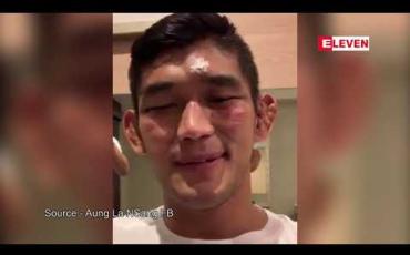 Embedded thumbnail for အားပေးသူပရိသတ်များကို အောင်လအန်ဆန် ကျေးဇူးတင်စကားဆို
