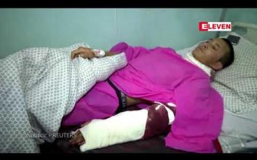Embedded thumbnail for အာဖဂန်နစ္စတန်ရှိ ကဘူးတက္ကသိုလ်ကို သေနတ်သမားများ ဝင်ရောက်စီးနင်း တိုက်ခိုက်ခဲ့သဖြင့် ၂၂ ဦးထက်မနည်း သေဆုံး 