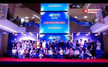 Embedded thumbnail for &amp;quot; Acne Scar Challenge နောက်ဆုံးအဆင့် ဇကာတင်ရွေးချယ်ပွဲကြီး