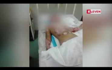 Embedded thumbnail for အရက်မူးနေသူနှစ်ဦး စကားများရန်ဖြစ်ရာမှ ကြားထဲက ဘဝတစ်ခုလုံး ပေးဆပ်လိုက်ရသည့် ၁၀ နှစ်အရွယ် မိန်းကလေးငယ် တစ်ဦး