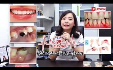 Embedded thumbnail for လူတိုင်းအတွက်အရေးကြီးတဲ့သွားကျန်းမာရေး ( ရုပ်သံအစီအစဉ် )
