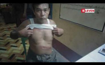 Embedded thumbnail for လမိုင်းမြို့ရှိ အငြင်းပွားမှုဖြစ်ပွားနေသော အွန်လိုင်းလေလံစုမဲဒိုင် တစ်ဦးဖြစ်သူ၏ ဆွေမျိုးအချို့အား ခြိမ်းခြောက် ဖမ်းဆီး ခေါ်ဆောင်မှုဖြစ်ပွားခဲ့
