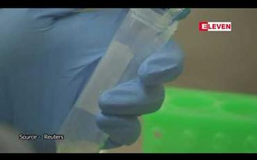 Embedded thumbnail for HIV ကူးစက်ခံရသည့် အမှားရလဒ်ထွက်ပေါ်ခဲ့သဖြင့် ကွင်းစလန်းတက္ကသိုလ်၏ ကိုရိုနာဗိုင်းရပ်စ်ကာကွယ်ဆေးကို ဝယ်ယူမည့်အစီအစဉ်အား သြစတြေးလျဖျက်သိမ်း