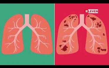 Embedded thumbnail for မြန်မာနိုင်ငံတွင် တီဘီရောဂါဖြစ်ပွားမှုနှုန်း ၅၀ ရာခိုင်နှုန်းကျော်ကျဆင်းသွားသော်လည်း ရန်ကုန်တိုင်းတွင်မူ သိသိသာသာ မကျဆင်းဟု ပြည်ထောင်စုဝန်ကြီး ပြော