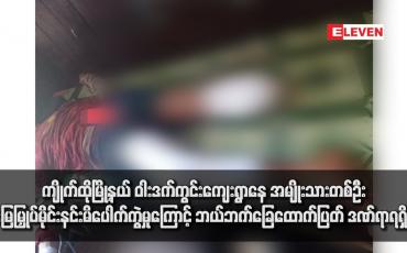 Embedded thumbnail for ကျိုက်ထိုမြို့နယ် ဝါးဒက်ကွင်းကျေးရွာနေ အမျိုးသားတစ်ဦး မြေမြှုပ်မိုင်းနင်းမိပေါက်ကွဲမှုကြောင့် ဘယ်ဘက်ခြေထောက်ပြတ် ဒဏ်ရာ ရရှိခဲ့