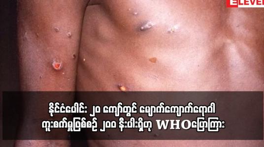 Embedded thumbnail for နိုင်ငံပေါင်း ၂၀ ကျော်တွင် မျောက်ကျောက်ရောဂါ ကူးစက်မှုဖြစ်စဉ် ၂၀ဝ နီးပါးရှိဟု WHOပြောကြား