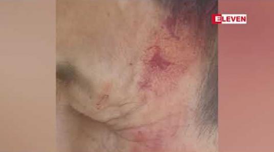 Embedded thumbnail for တောင်ကြီးမြို့ ရတနာသီရိရပ်ကွက် အုပ်ချုပ်ရေးမှူးကို  ကျူးကျော်နေထိုင်သူတစ်ဦးက ဓါးဖြင့်ခုတ်မှုဖြစ်ပွားခဲ့ 