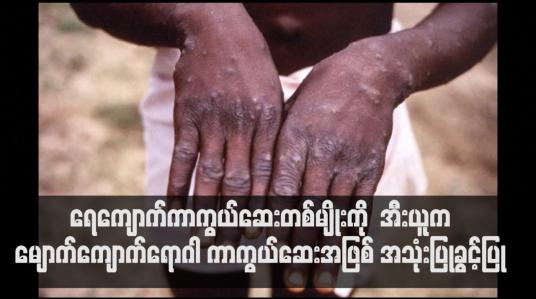 Embedded thumbnail for အီးယူက မျောက်ကျောက်ရောဂါ ကာကွယ်ဆေးအဖြစ် အသုံးပြုခွင့်ပြု