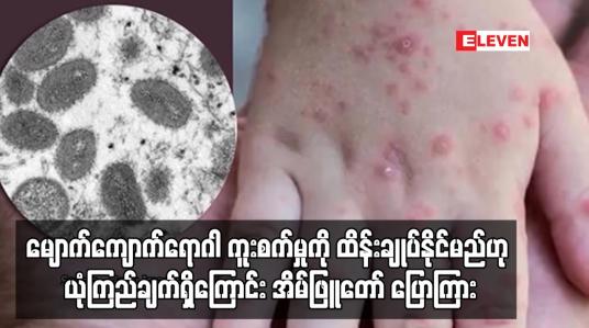 Embedded thumbnail for မျောက်ကျောက်ရောဂါ ကူးစက်မှုကို ထိန်းချုပ်နိုင်မည်ဟု ယုံကြည်ချက်ရှိကြောင်း အိမ်ဖြူတော် ပြောကြား (ရုပ်သံ)