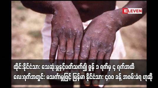 Embedded thumbnail for အမေရိကန်ကျန်းမာရေးအာဏာပိုင်များက ဆရာဝန်များအား မျောက်ကျောက်ရောဂါ ကူးစက်ခံရခြင်း ရှိ၊မရှိ
