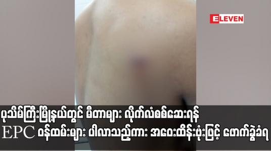 Embedded thumbnail for ပုသိမ်ကြီးမြို့နယ်တွင် မီတာများ လိုက်လံစစ်ဆေးရန် EPC ဝန်ထမ်းများပါလာသည့်ကား အဝေးထိန်းဗုံးဖြင့်